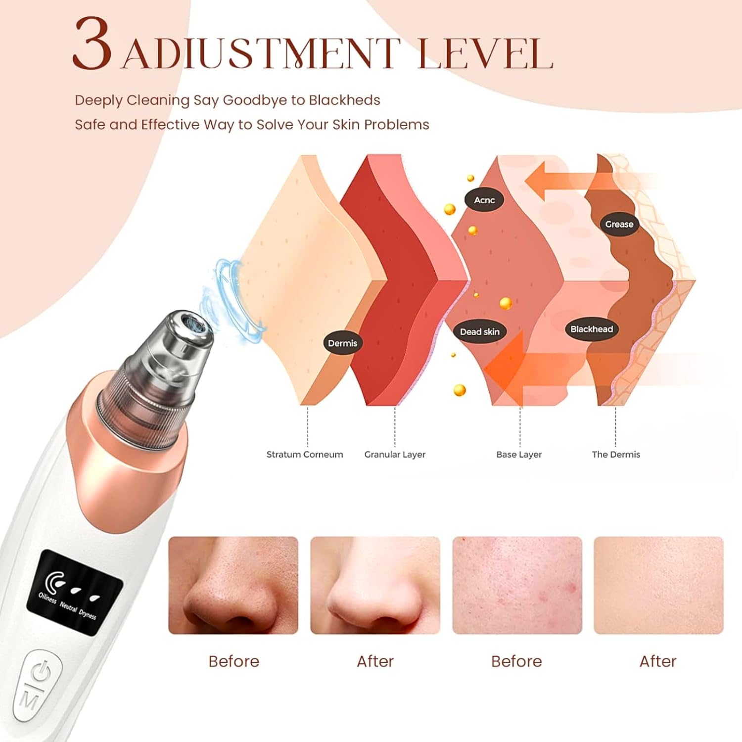 Blackhead Remover Vacuum, Electric Pore Vacuum Cleaner for Black Heads Removals, Deep Clean Facial Kit For Women, Rechargeable Pore Extractor Tool Blackhead Suction Device (Charge Before First Use)